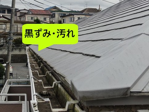 黒ずみ・汚れ